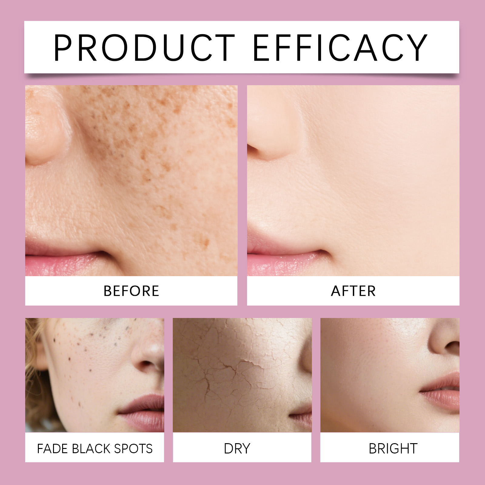 Korean Calcium Collagen Skinca - Niacinamide Brightening Serum 评论和价格